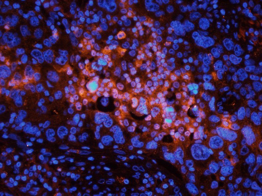 p63 Rabbit Polyclonal Antibody