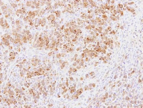 PABPC3 Rabbit Polyclonal Antibody
