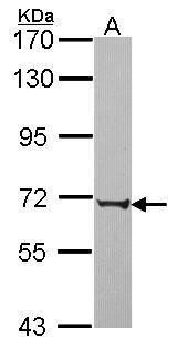 PABPC3 Rabbit Polyclonal Antibody