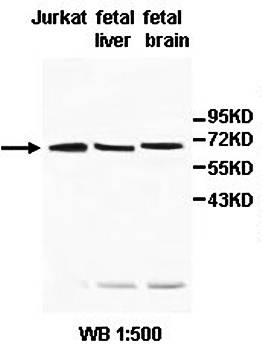 PABPC3 Rabbit Polyclonal Antibody