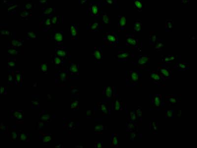 PABPN1 Antibody