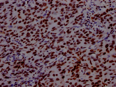 PABPN1 Antibody