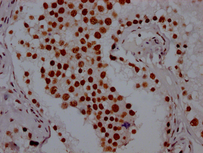 PABPN1 Antibody