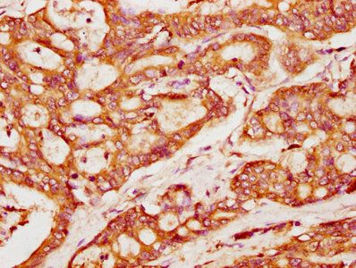 PACSIN2 Antibody