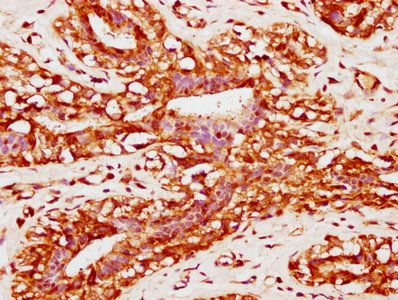 PACSIN2 Antibody