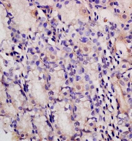 PAF Rabbit Polyclonal Antibody