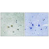 PAK1 Antibody