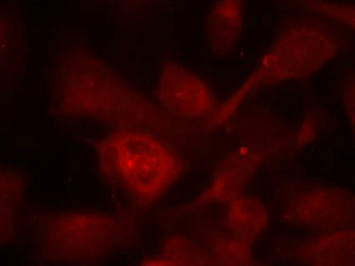 PAK1/PAK2/PAK3 Antibody