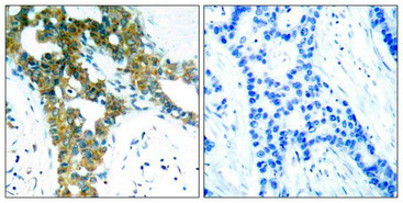 PAK1/PAK2/PAK3 Antibody