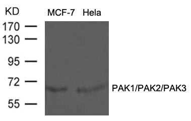 PAK1/PAK2/PAK3 Antibody