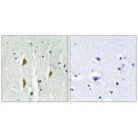PAK1/PAK2/PAK3 Antibody