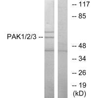 PAK1/PAK2/PAK3 Antibody