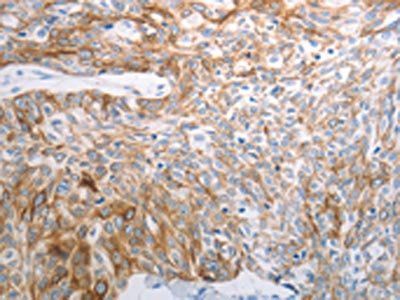 PAK1 Antibody
