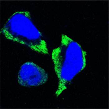 PAK2 Antibody