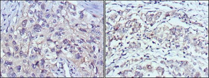 PAK2 Antibody