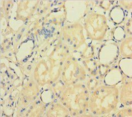 PAPPA Antibody
