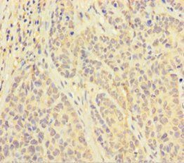 PAPPA Antibody