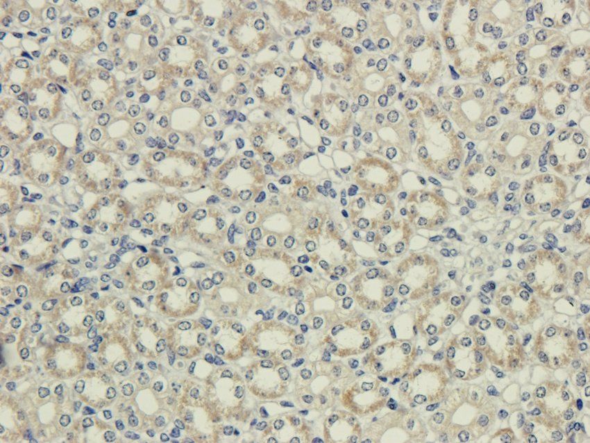 PAR2 Rabbit Polyclonal Antibody