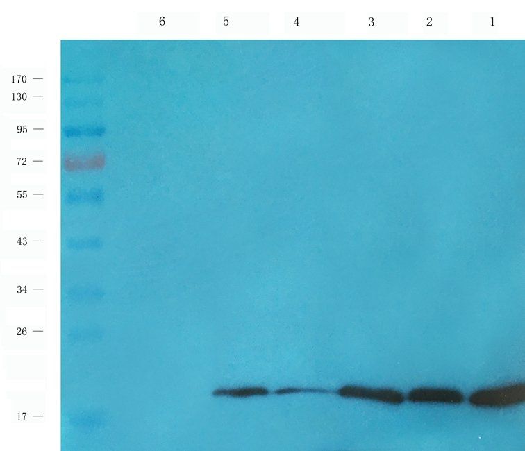 PAR2 Rabbit Polyclonal Antibody