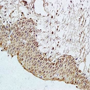 PAR3 Rabbit Polyclonal Antibody