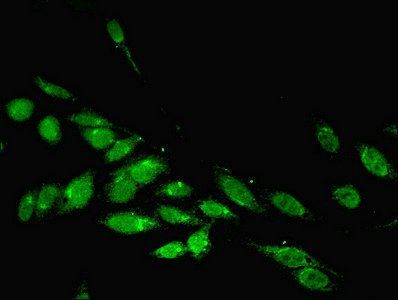 PARP3 Antibody