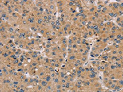 PARP3 Antibody