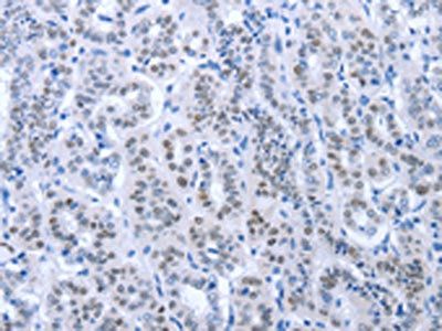PAX8 Antibody