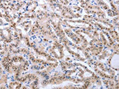 PAX8 Antibody
