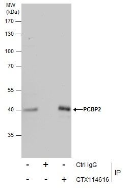 PCBP2 Rabbit Polyclonal Antibody