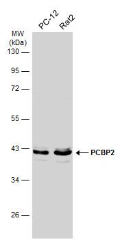 PCBP2 Rabbit Polyclonal Antibody