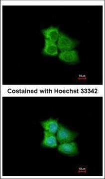 PCMT1 Rabbit Polyclonal Antibody