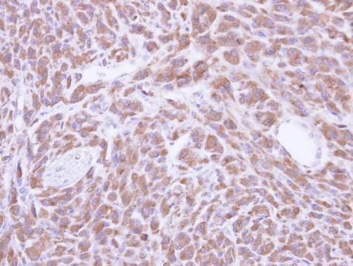 PCMT1 Rabbit Polyclonal Antibody