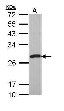 PCMT1 Rabbit Polyclonal Antibody