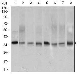 PCNA