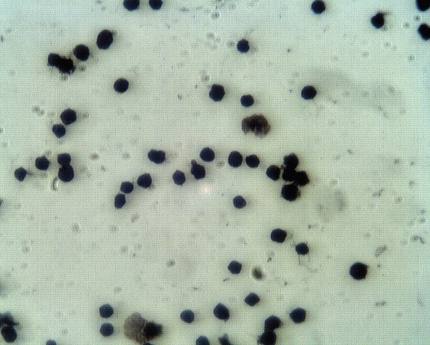 Rabbit anti Human Proprotein convertase subtilisin/kexin type 9 (PCSK9), NARC1 Antibody