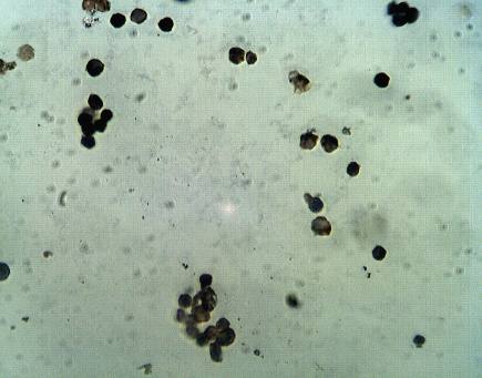 Rabbit anti Human Proprotein convertase subtilisin/kexin type 9 (PCSK9), NARC1