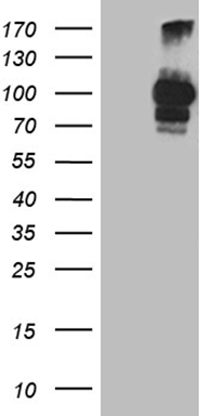 PCSK9 Antibody