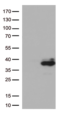 PCSK9 Antibody