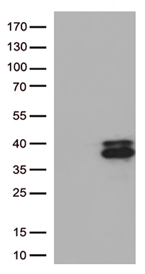 PCSK9 Antibody