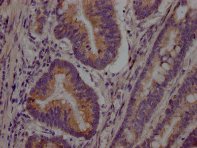 PCSK9 Antibody