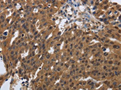 PDCD7 Antibody