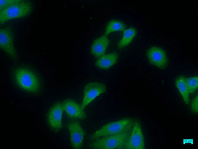 PDE8A Antibody