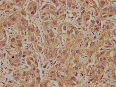 PDE8A Antibody