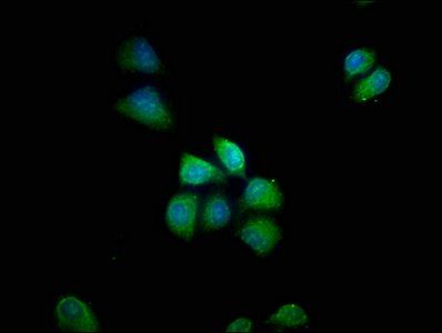 PDE8B Antibody