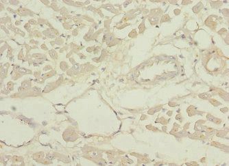 PDHB Antibody