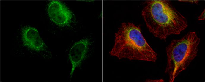 PDI Rabbit Polyclonal Antibody