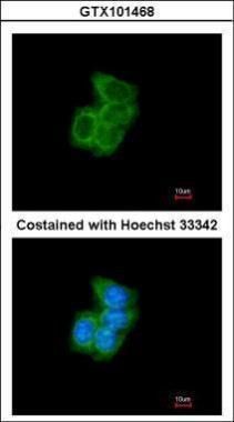 PDI Rabbit Polyclonal Antibody