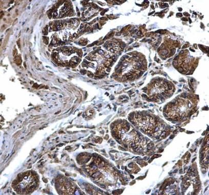 PDI Rabbit Polyclonal Antibody