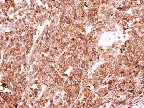 PDI Rabbit Polyclonal Antibody