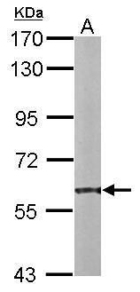 PDI Rabbit Polyclonal Antibody